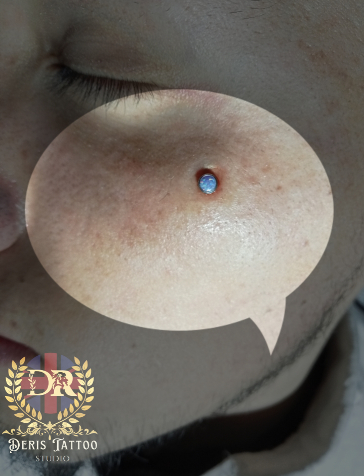 Microderma 4